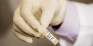 A New Strain of HIV Is Recorded Under Group That Caused Pandemic